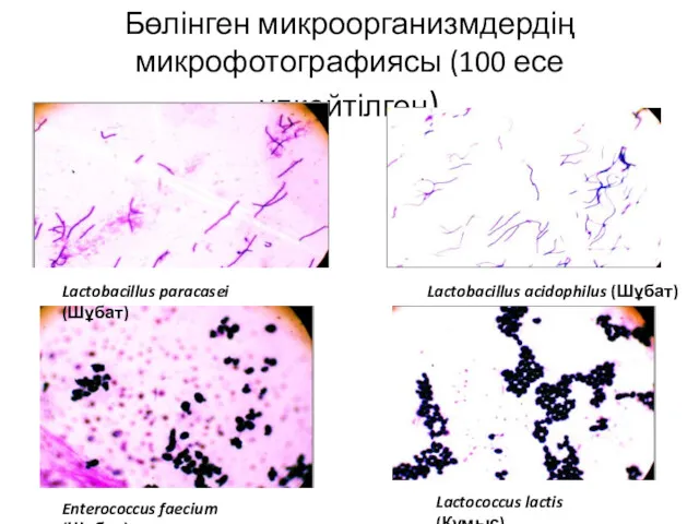 Бөлінген микроорганизмдердің микрофотографиясы (100 есе үлкейтілген) Lactobacillus paracasei (Шұбат) Enterococcus