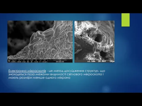 Електронна мікроскопія - це метод дослідження структур, що знаходяться поза