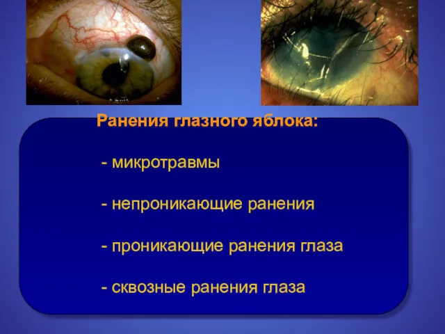 Ранения глазного яблока: - микротравмы - непроникающие ранения - проникающие ранения глаза - сквозные ранения глаза