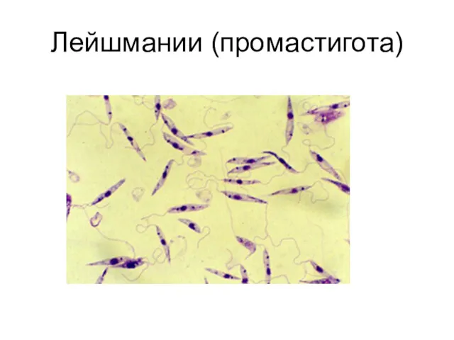 Лейшмании (промастигота)