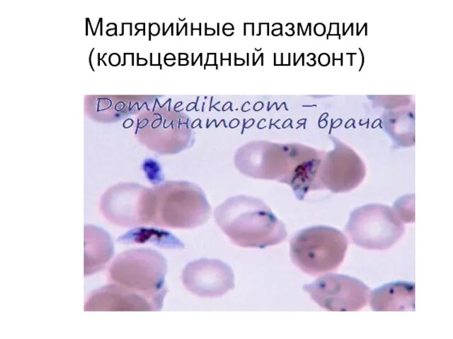 Малярийные плазмодии (кольцевидный шизонт)