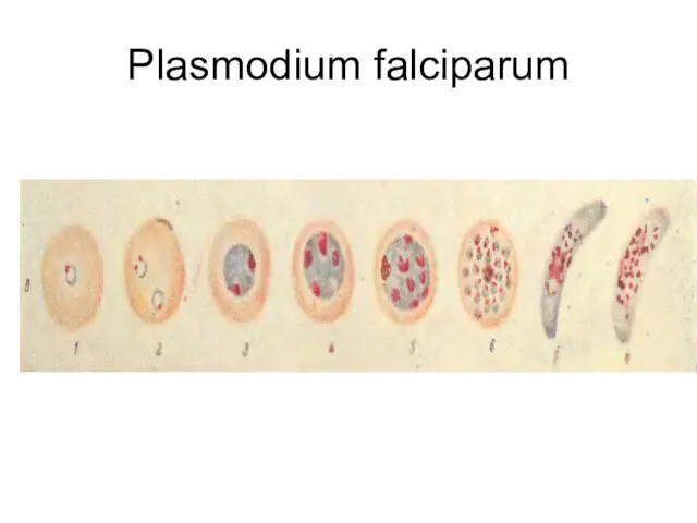 Plasmodium falciparum