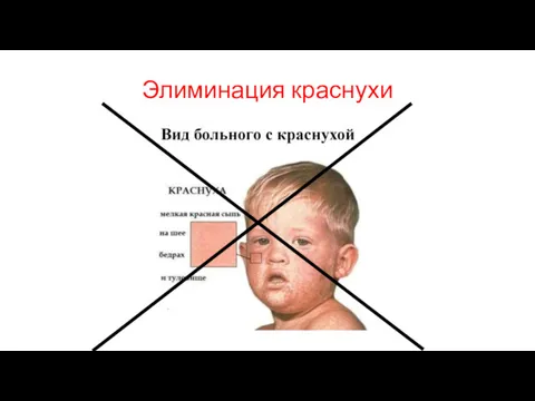 Элиминация краснухи