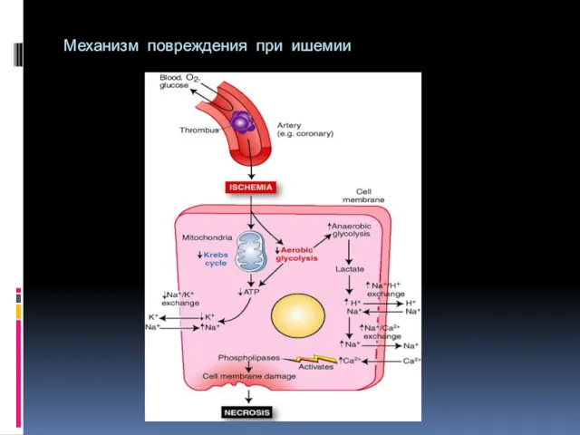 Механизм повреждения при ишемии