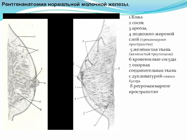 Рентгенанатомия нормальной молочной железы. 1.Кожа 2 сосок 3 ареола, 4