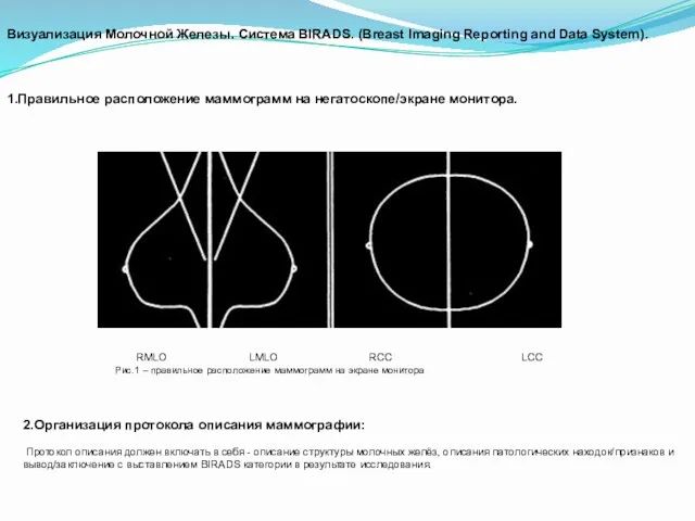 Визуализация Молочной Железы. Система BIRADS. (Breast Imaging Reporting and Data