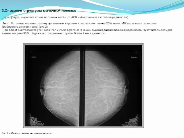 3.Описание структуры молочной железы: По структуре, выделяют 4 типа молочных