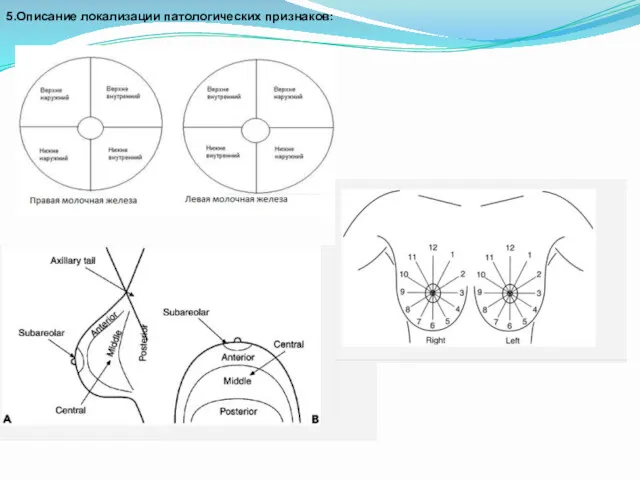 5.Описание локализации патологических признаков: