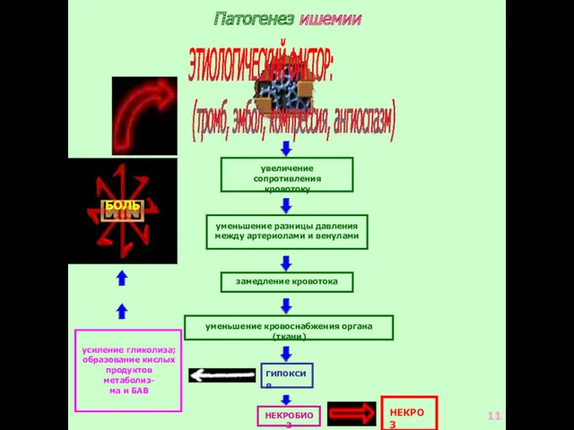 Патогенез ишемии ЭТИОЛОГИЧЕСКИЙ ФАКТОР: (тромб, эмбол, компрессия, ангиоспазм) увеличение сопротивления