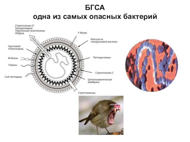БГСА одна из самых опасных бактерий