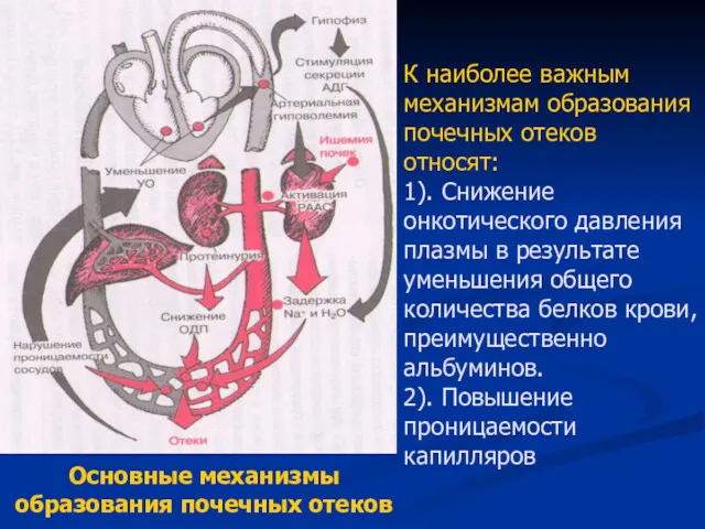 К наиболее важным механизмам образования почечных отеков относят: 1). Снижение