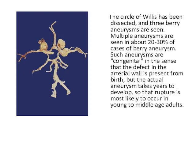 The circle of Willis has been dissected, and three berry