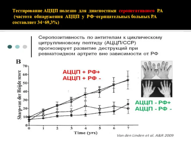 Тестирование АЦЦП полезно для диагностики серонегативного РА (частота обнаружения АЦЦП у РФ‐отрицательных больных РА составляет 34‐69,3%)
