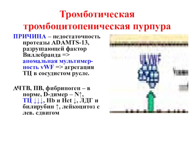 Тромботическая тромбоцитопеническая пурпура ПРИЧИНА – недостаточность протеазы ADAMTS-13, разрушающей фактор