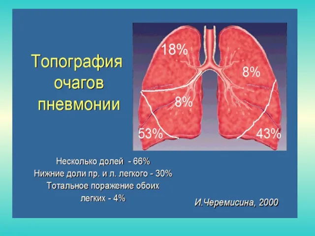 ТОПОГРАФИЯ ОЧАГОВ ПНЕВМОНИИ