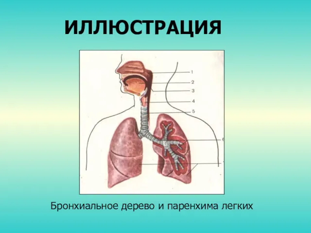 ИЛЛЮСТРАЦИЯ Бронхиальное дерево и паренхима легких