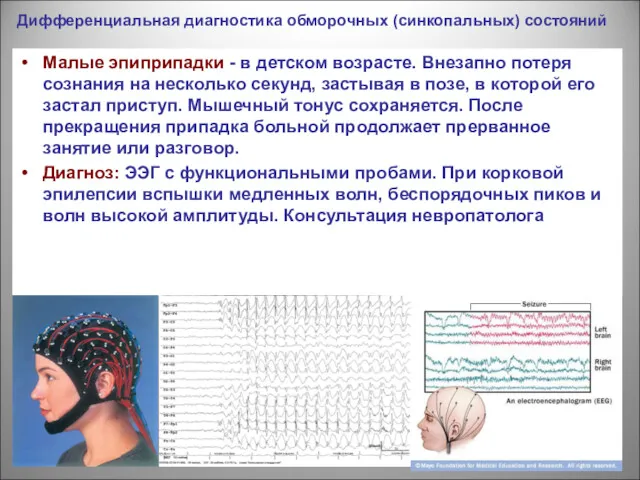 Дифференциальная диагностика обморочных (синкопальных) состояний Малые эпиприпадки - в детском возрасте. Внезапно потеря