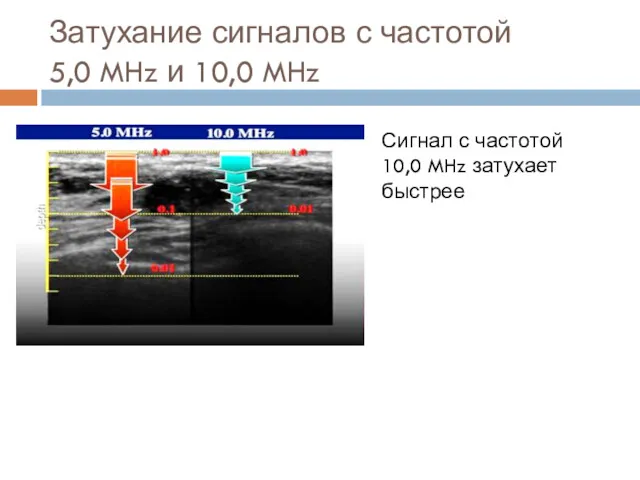 Затухание сигналов с частотой 5,0 MHz и 10,0 MHz Сигнал с частотой 10,0 MHz затухает быстрее