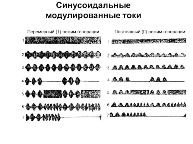 Синусоидальные модулированные токи