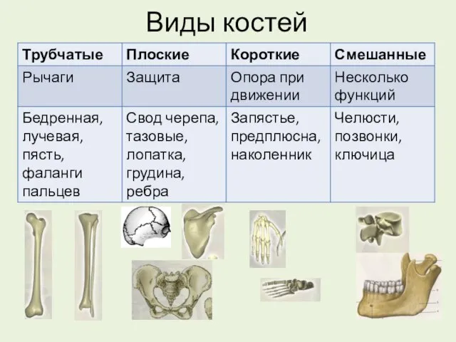 Виды костей