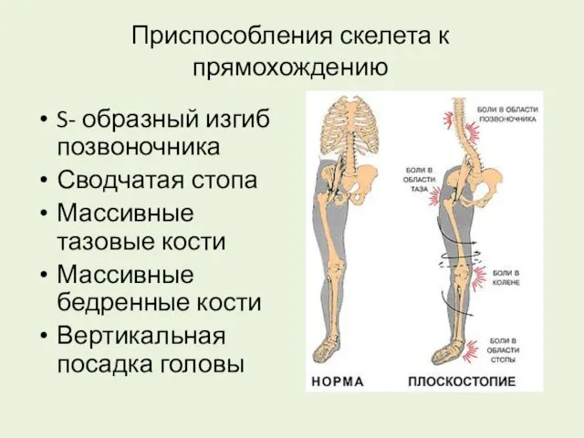 Приспособления скелета к прямохождению S- образный изгиб позвоночника Сводчатая стопа