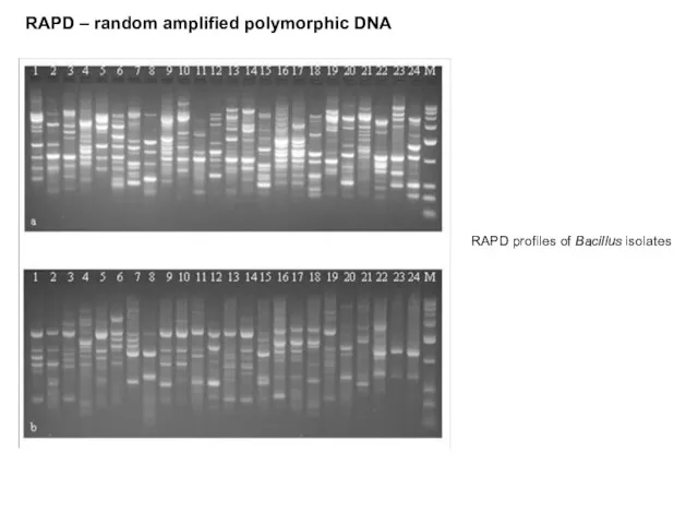 RAPD – random amplified polymorphic DNA RAPD profiles of Bacillus isolates