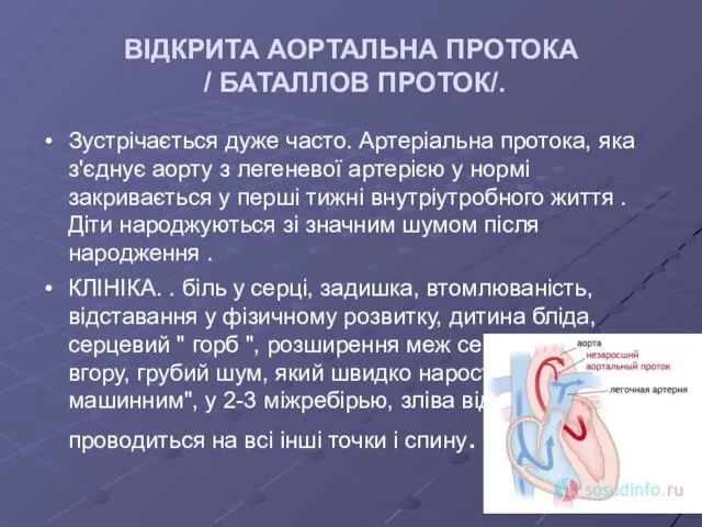 ВІДКРИТА АОРТАЛЬНА ПРОТОКА / БАТАЛЛОВ ПРОТОК/. Зустрічається дуже часто. Артеріальна