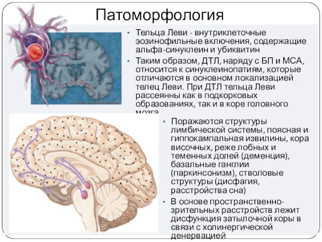 Патоморфология Тельца Леви - внутриклеточные эозинофильные включения, содержащие альфа-синуклеин и убиквитин Таким образом,