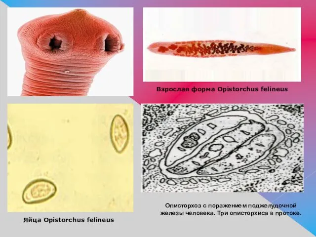 Взрослая форма Opistorchus felineus Яйца Opistorchus felineus Описторхоз с поражением