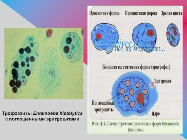 Трофозоиты Entamoeba histolytica с поглощёнными эритроцитами