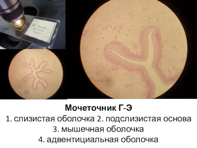 Мочеточник Г-Э 1. слизистая оболочка 2. подслизистая основа 3. мышечная оболочка 4. адвентициальная оболочка