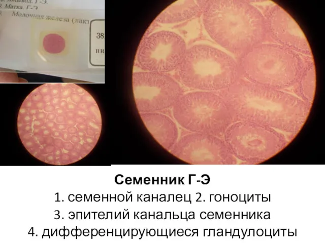 Семенник Г-Э 1. семенной каналец 2. гоноциты 3. эпителий канальца семенника 4. дифференцирующиеся гландулоциты