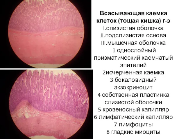 Всасывающая каемка клеток (тощая кишка) г-э I.слизистая оболочка II.подслизистая основа