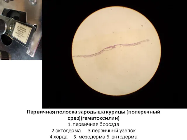 Первичная полоска зародыша курицы (поперечный срез)(гематоксилин) 1. первичная борозда 2.эктодерма