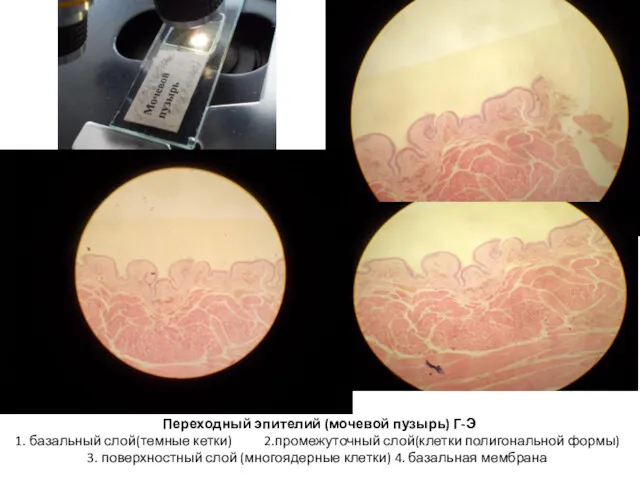Переходный эпителий (мочевой пузырь) Г-Э 1. базальный слой(темные кетки) 2.промежуточный