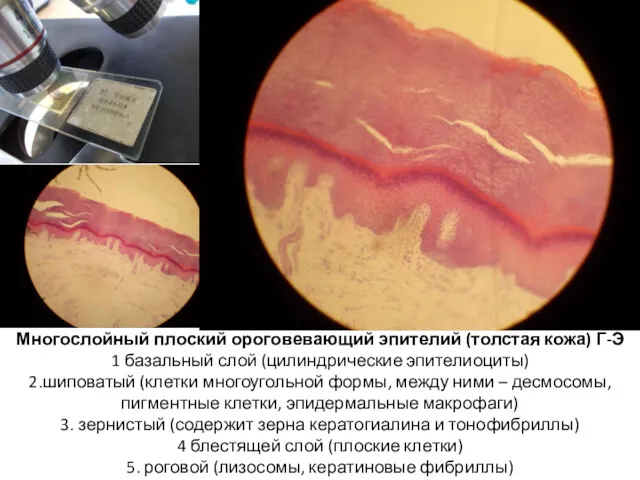 Многослойный плоский ороговевающий эпителий (толстая кожа) Г-Э 1 базальный слой