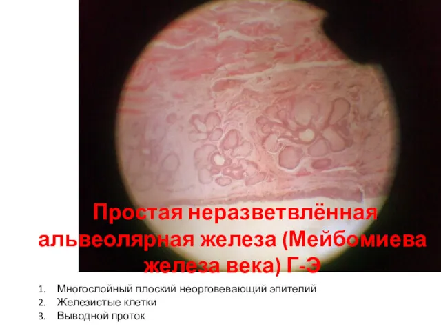 Простая неразветвлённая альвеолярная железа (Мейбомиева железа века) Г-Э Многослойный плоский неорговевающий эпителий Железистые клетки Выводной проток