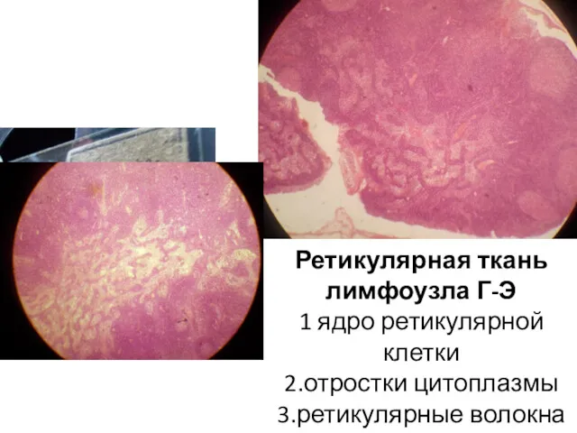 Ретикулярная ткань лимфоузла Г-Э 1 ядро ретикулярной клетки 2.отростки цитоплазмы 3.ретикулярные волокна