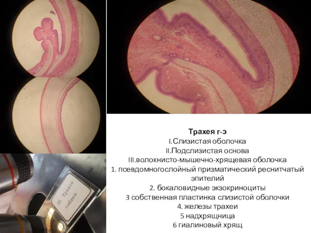 Трахея г-э I.Слизистая оболочка II.Подслизистая основа III.волокнисто-мышечно-хрящевая оболочка 1. псевдомногослойный