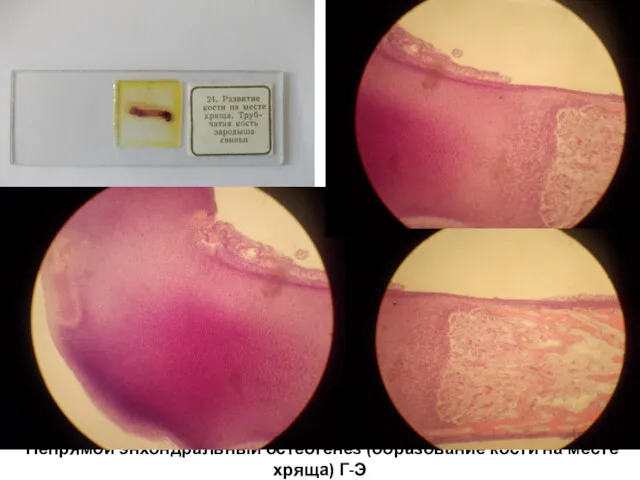 Непрямой энхондральный остеогенез (образование кости на месте хряща) Г-Э