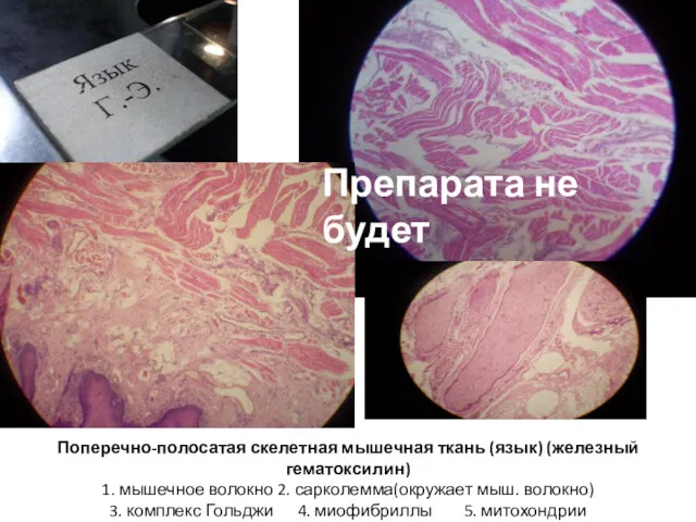 Поперечно-полосатая скелетная мышечная ткань (язык) (железный гематоксилин) 1. мышечное волокно