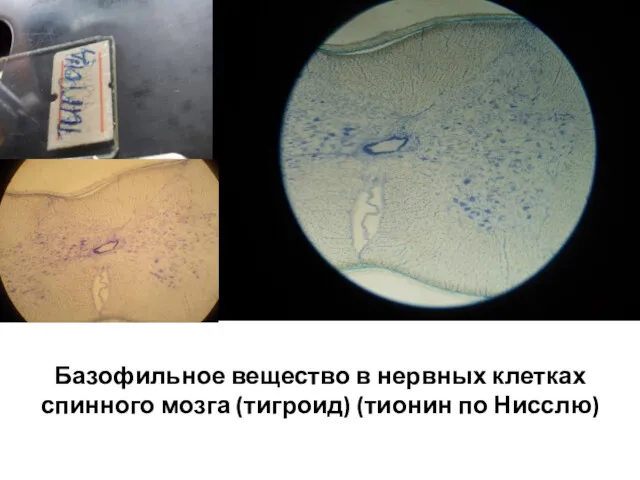 Базофильное вещество в нервных клетках спинного мозга (тигроид) (тионин по Нисслю)