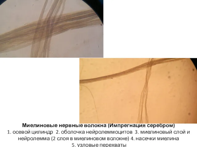 Миелиновые нервные волокна (Импрегнация серебром) 1. осевой цилиндр 2. оболочка