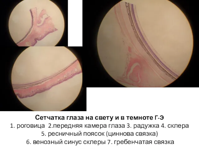 Сетчатка глаза на свету и в темноте Г-Э 1. роговица