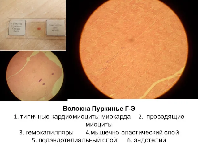 Волокна Пуркинье Г-Э 1. типичные кардиомиоциты миокарда 2. проводящие миоциты