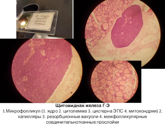 Щитовидная железа Г-Э 1.Микрофолликул (1. ядро 2. цитолемма 3. цистерна