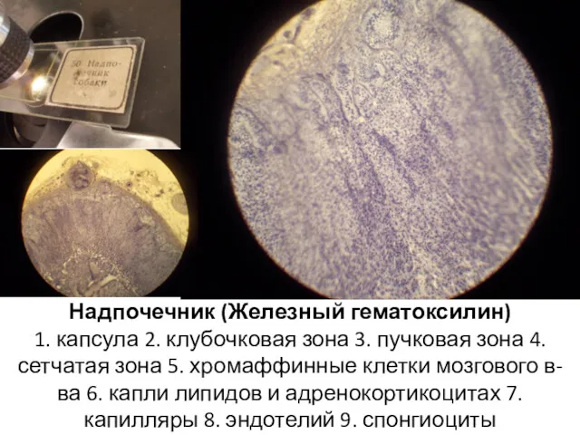 Надпочечник (Железный гематоксилин) 1. капсула 2. клубочковая зона 3. пучковая