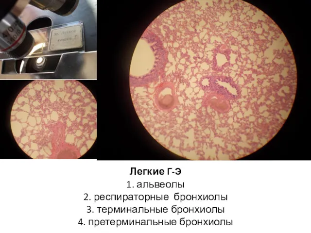 Легкие Г-Э 1. альвеолы 2. респираторные бронхиолы 3. терминальные бронхиолы 4. претерминальные бронхиолы