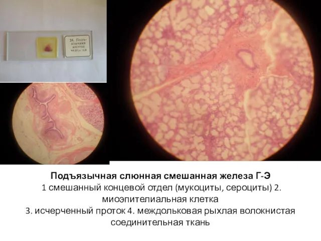 Подъязычная слюнная смешанная железа Г-Э 1 смешанный концевой отдел (мукоциты,