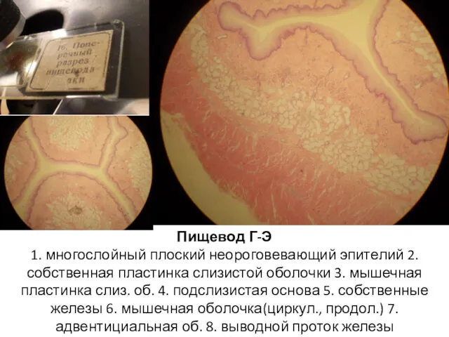 Пищевод Г-Э 1. многослойный плоский неороговевающий эпителий 2. собственная пластинка